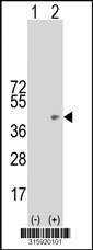 Western blot analysis of his-tag CCRL1 (arrow) using his tag antibody. 293T cell lysates (2 ug/lane) either nontransfected (Lane 1) or transiently transfected with the CCRL1 gene‘