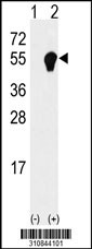 Western blot analysis of his-tag FEN1 (arrow) using his tag antibody. 293 cell lysates (2 ug/lane) either nontransfected (Lane 1) or transiently transfected with the FEN1 gene