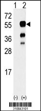 Western blot analysis of his-tag ERGIC3 (arrow) using his tag antibody. 293 cell lysates (2 ug/lane) either nontransfected (Lane 1) or transiently transfected with the ERGIC3 gene