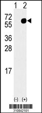 Western blot analysis of his-tag COCH (arrow) using his tag antibody. 293 cell lysates (2 ug/lane) either nontransfected (Lane 1) or transiently transfected with the COCH gene