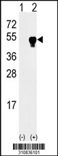 Western blot analysis of his-tag ACTC1 (arrow) using his tag antibody. 293 cell lysates (2 ug/lane) either nontransfected (Lane 1) or transiently transfected with the ACTC1 gene