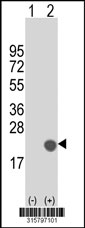 Western blot analysis of his-tag GBA3 (arrow) using his tag antibody. 293T cell lysates (2 ug/lane) either nontransfected (Lane 1) or transiently transfected with the GBA3 gene‘