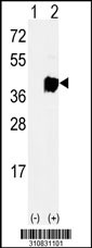 Western blot analysis of his-tag SAE1 (arrow) using his tag antibody. 293 cell lysates (2 ug/lane) either nontransfected (Lane 1) or transiently transfected with the SAE1 gene