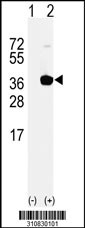 Western blot analysis of his-tag RDH11 (arrow) using his tag antibody. 293 cell lysates (2 ug/lane) either nontransfected (Lane 1) or transiently transfected with the RDH11 gene
