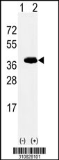 Western blot analysis of his-tag POLDIP2 (arrow) using his tag antibody. 293 cell lysates (2 ug/lane) either nontransfected (Lane 1) or transiently transfected with the POLDIP2 gene