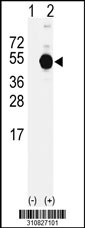 Western blot analysis of his-tag PITX1 (arrow) using his tag antibody. 293 cell lysates (2 ug/lane) either nontransfected (Lane 1) or transiently transfected with the PITX1 gene
