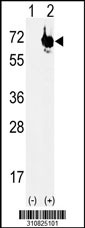 Western blot analysis of his-tag NCL (arrow) using his tag antibody. 293 cell lysates (2 ug/lane) either nontransfected (Lane 1) or transiently transfected with the NCL gene