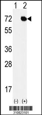 Western blot analysis of his-tag MMP2 (arrow) using his tag antibody. 293 cell lysates (2 ug/lane) either nontransfected (Lane 1) or transiently transfected with the MMP2 gene