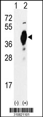 Western blot analysis of his-tag JTV1 (arrow) using his tag antibody. 293 cell lysates (2 ug/lane) either nontransfected (Lane 1) or transiently transfected with the JTV1 gene