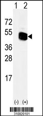 Western blot analysis of his-tag HOMER1 (arrow) using his tag antibody. 293 cell lysates (2 ug/lane) either nontransfected (Lane 1) or transiently transfected with the HOMER1 gene