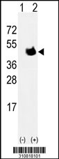 Western blot analysis of his-tag HLA-A (arrow) using his tag antibody. 293 cell lysates (2 ug/lane) either nontransfected (Lane 1) or transiently transfected with the HLA-A gene