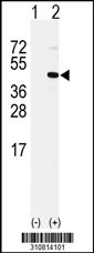 Western blot analysis of his-tag DPPA2 (arrow) using his tag antibody. 293 cell lysates (2 ug/lane) either nontransfected (Lane 1) or transiently transfected with the DPPA2 gene