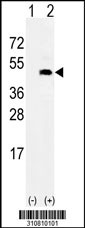 Western blot analysis of his-tag DCN (arrow) using his tag antibody. 293 cell lysates (2 ug/lane) either nontransfected (Lane 1) or transiently transfected with the DCN gene
