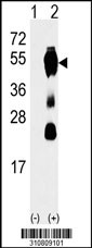 Western blot analysis of his-tag CXADR (arrow) using his tag antibody. 293 cell lysates (2 ug/lane) either nontransfected (Lane 1) or transiently transfected with the CXADR gene