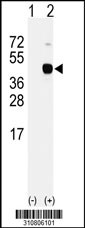Western blot analysis of his-tag CAPN3 (arrow) using his tag antibody. 293 cell lysates (2 ug/lane) either nontransfected (Lane 1) or transiently transfected with the CAPN3 gene