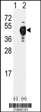 Western blot analysis of his-tag C19orf62 (arrow) using his tag antibody. 293 cell lysates (2 ug/lane) either nontransfected (Lane 1) or transiently transfected with the C19orf62 gene
