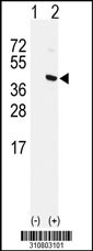 Western blot analysis of his-tag ASPA (arrow) using his tag antibody. 293 cell lysates (2 ug/lane) either nontransfected (Lane 1) or transiently transfected with the ASPA gene