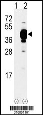 Western blot analysis of his-tag AKR1A1 (arrow) using his tag antibody. 293 cell lysates (2 ug/lane) either nontransfected (Lane 1) or transiently transfected with the AKR1A1 gene