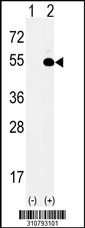 Western blot analysis of his-tag TIMM50 (arrow) using his tag antibody. 293 cell lysates (2 ug/lane) either nontransfected (Lane 1) or transiently transfected with the TIMM50 gene