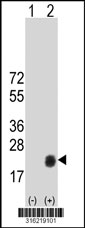 Western blot analysis of his-tag CABP5 (arrow) using his tag antibody. 293T cell lysates (2 ug/lane) either nontransfected (Lane 1) or transiently transfected with the CABP5 gene‘
