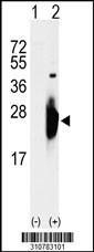 Western blot analysis of his-tag PRDX1 (arrow) using his tag antibody. 293 cell lysates (2 ug/lane) either nontransfected (Lane 1) or transiently transfected with the PRDX1 gene