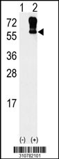Western blot analysis of his-tag PPP2R5C (arrow) using his tag antibody. 293 cell lysates (2 ug/lane) either nontransfected (Lane 1) or transiently transfected with the PPP2R5C gene
