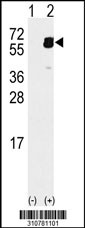 Western blot analysis of his-tag PPP2R2A (arrow) using his tag antibody. 293 cell lysates (2 ug/lane) either nontransfected (Lane 1) or transiently transfected with the PPP2R2A gene