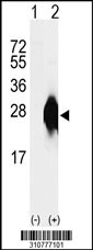 Western blot analysis of his-tag MID1IP1 (arrow) using his tag antibody. 293 cell lysates (2 ug/lane) either nontransfected (Lane 1) or transiently transfected with the MID1IP1 gene