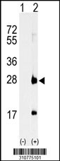 Western blot analysis of his-tag METTL7A (arrow) using his tag antibody. 293 cell lysates (2 ug/lane) either nontransfected (Lane 1) or transiently transfected with the METTL7A gene