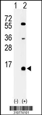Western blot analysis of his-tag MAX (arrow) using his tag antibody. 293 cell lysates (2 ug/lane) either nontransfected (Lane 1) or transiently transfected with the MAX gene
