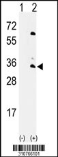 Western blot analysis of his-tag GNB3 (arrow) using his tag antibody. 293 cell lysates (2 ug/lane) either nontransfected (Lane 1) or transiently transfected with the GNB3 gene