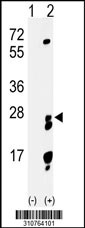 Western blot analysis of his-tag GJB2 (arrow) using his tag antibody. 293 cell lysates (2 ug/lane) either nontransfected (Lane 1) or transiently transfected with the GJB2 gene