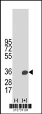 Western blot analysis of his-tag FAM78A (arrow) using his tag antibody. 293T cell lysates (2 ug/lane) either nontransfected (Lane 1) or transiently transfected with the FAM78A gene‘
