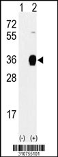 Western blot analysis of his-tag CDCA8 (arrow) using his tag antibody. 293 cell lysates (2 ug/lane) either nontransfected (Lane 1) or transiently transfected with the CDCA8 gene