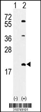 Western blot analysis of his-tag ANGEL2 (arrow) using his tag antibody. 293 cell lysates (2 ug/lane) either nontransfected (Lane 1) or transiently transfected with the ANGEL2 gene
