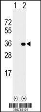 Western blot analysis of his-tag ALKBH8 (arrow) using his tag antibody. 293 cell lysates (2 ug/lane) either nontransfected (Lane 1) or transiently transfected with the ALKBH8 gene