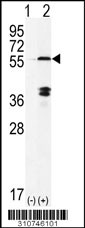 Western blot analysis of his-tag TRIM27 (arrow) using his tag antibody. 293 cell lysates (2 ug/lane) either nontransfected (Lane 1) or transiently transfected with the TRIM27 gene