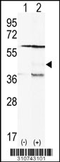Western blot analysis of his-tag SGMS1 (arrow) using his tag antibody. 293 cell lysates (2 ug/lane) either nontransfected (Lane 1) or transiently transfected with the SGMS1 gene