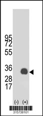 Western blot analysis of his-tag TPSB2 (arrow) using his tag antibody. 293T cell lysates (2 ug/lane) either nontransfected (Lane 1) or transiently transfected with the TPSB2 gene‘