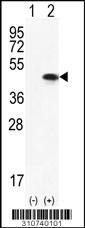 Western blot analysis of his-tag PRKAG1 (arrow) using his tag antibody. 293 cell lysates (2 ug/lane) either nontransfected (Lane 1) or transiently transfected with the PRKAG1 gene