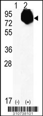 Western blot analysis of his-tag NTRK2 (arrow) using his tag antibody. 293 cell lysates (2 ug/lane) either nontransfected (Lane 1) or transiently transfected with the NTRK2 gene