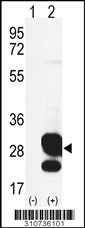 Western blot analysis of his-tag NDUFS4 (arrow) using his tag antibody. 293 cell lysates (2 ug/lane) either nontransfected (Lane 1) or transiently transfected with the NDUFS4 gene
