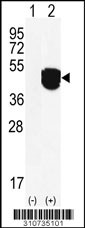 Western blot analysis of his-tag MAP2K6 (arrow) using his tag antibody. 293 cell lysates (2 ug/lane) either nontransfected (Lane 1) or transiently transfected with the MAP2K6 gene