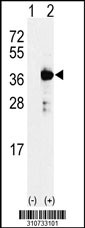 Western blot analysis of his-tag GNA11 (arrow) using his tag antibody. 293 cell lysates (2 ug/lane) either nontransfected (Lane 1) or transiently transfected with the GNA11 gene