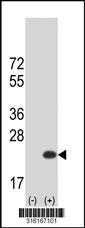 Western blot analysis of his-tag MORN5 (arrow) using his tag antibody. 293T cell lysates (2 ug/lane) either nontransfected (Lane 1) or transiently transfected with the MORN5 gene‘