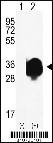 Western blot analysis of his-tag CNR2 (arrow) using his tag antibody. 293 cell lysates (2 ug/lane) either nontransfected (Lane 1) or transiently transfected with the CNR2 gene