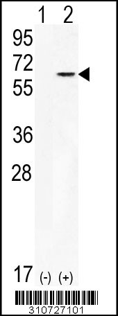 Western blot analysis of his-tag AKT2 (arrow) using his tag antibody. 293 cell lysates (2 ug/lane) either nontransfected (Lane 1) or transiently transfected with the AKT2 gene