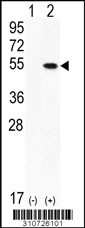 Western blot analysis of his-tag STK32B (arrow) using his tag antibody. 293 cell lysates (2 ug/lane) either nontransfected (Lane 1) or transiently transfected with the STK32B gene