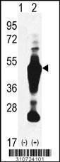 Western blot analysis of his-tag PPM1G (arrow) using his tag antibody. 293 cell lysates (2 ug/lane) either nontransfected (Lane 1) or transiently transfected with the PPM1G gene
