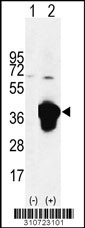 Western blot analysis of his-tag PDGFRA (arrow) using his tag antibody. 293 cell lysates (2 ug/lane) either nontransfected (Lane 1) or transiently transfected with the PDGFRA gene
